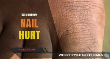Ingrown Toenail Pain: Causes, Symptoms, and Effective Relief Solutions