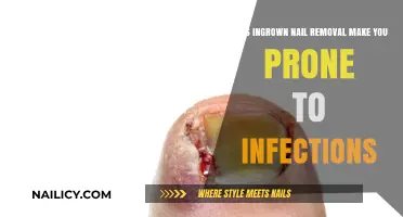 Ingrown Nail Removal: Infection Risk and Prevention