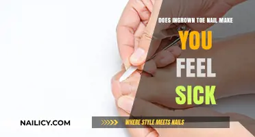Can Ingrown Toenails Cause Nausea and Overall Sickness?