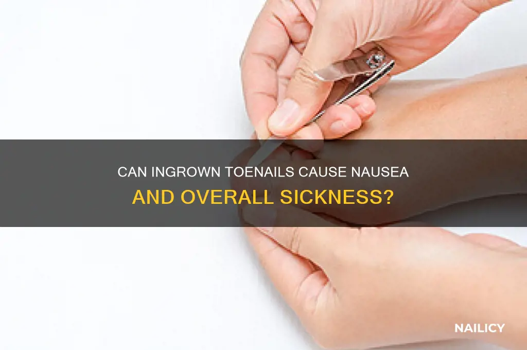 does ingrown toe nail make you feel sick