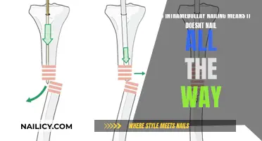 Intramedullary Nails: Partial or Full? Unlocking the Mystery