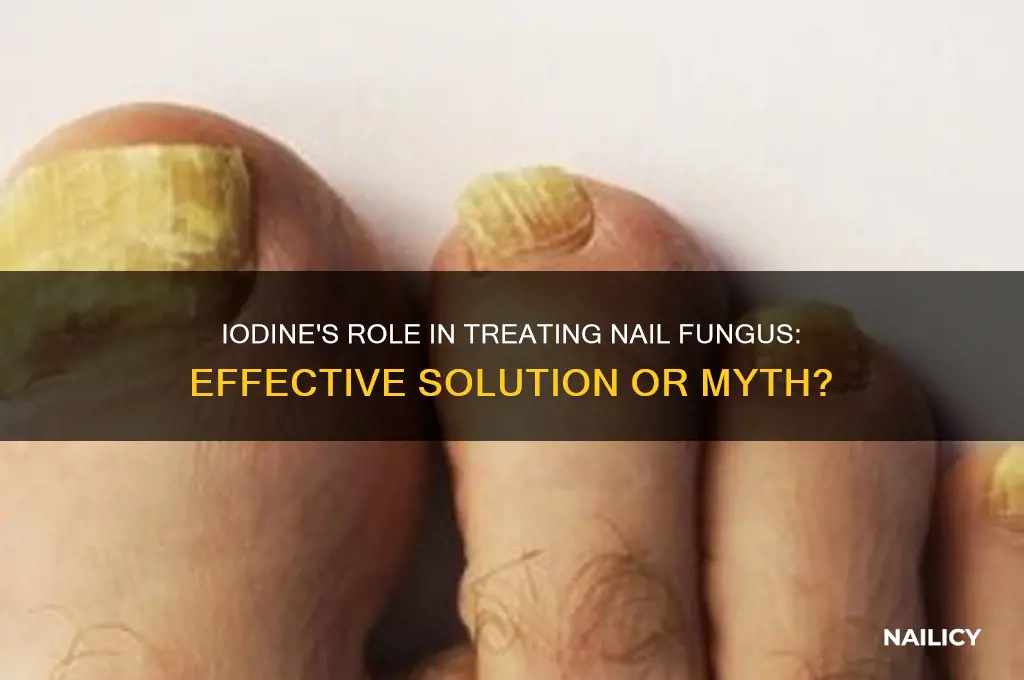 does iodine kill nail funhus