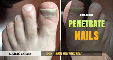 Iodine Penetration in Nails: Unveiling the Truth and Benefits