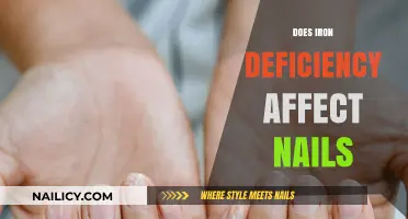 Iron Deficiency and Nail Health: Uncovering the Surprising Connection