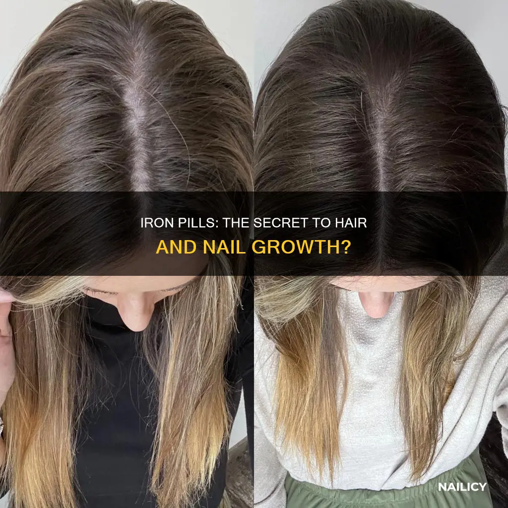 does iron pills make your hair and nails grow