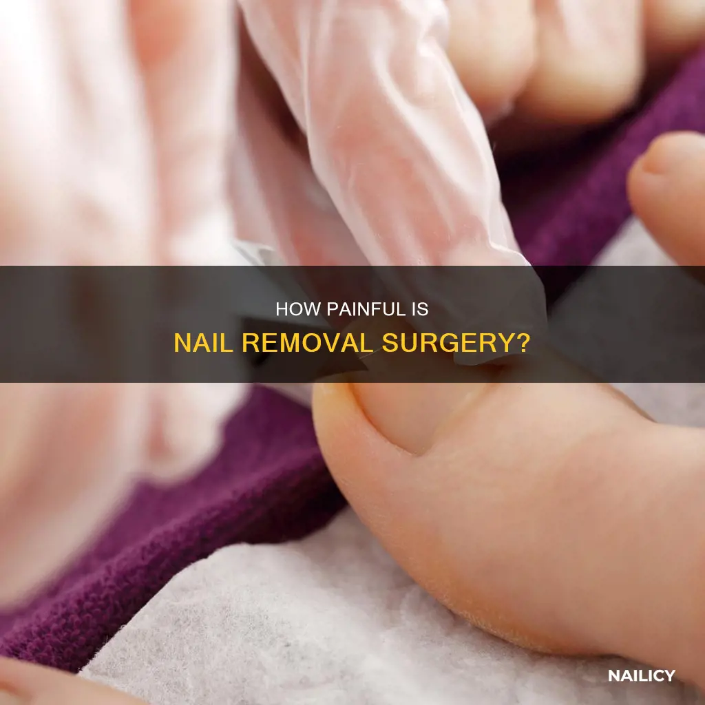 does it hurt nail removed