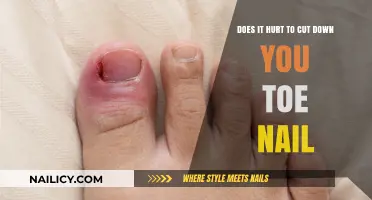 Toe Nail Cutting: Pain or Gain?