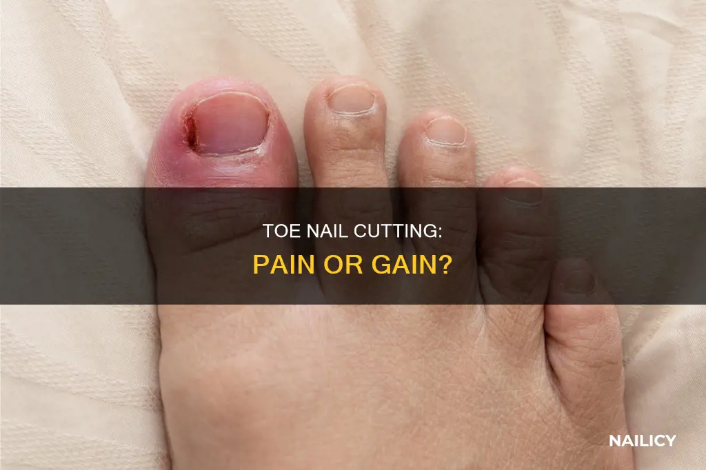 does it hurt to cut down you toe nail