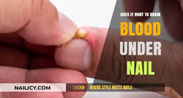 Does Draining Blood Under a Nail Cause Pain? Find Out Here