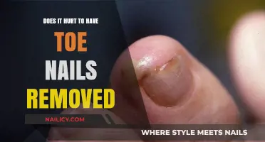 Toe Nail Removal: Is It Painful?