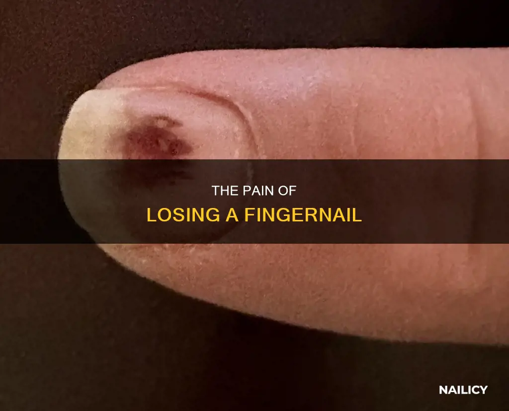 does it hurt when a finger nail falls off
