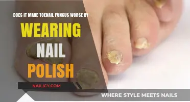 Wearing Nail Polish: Does It Worsen Toenail Fungus? Expert Insights