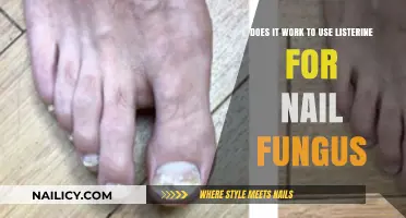 Exploring the Effectiveness of Listerine for Nail Fungus Treatment