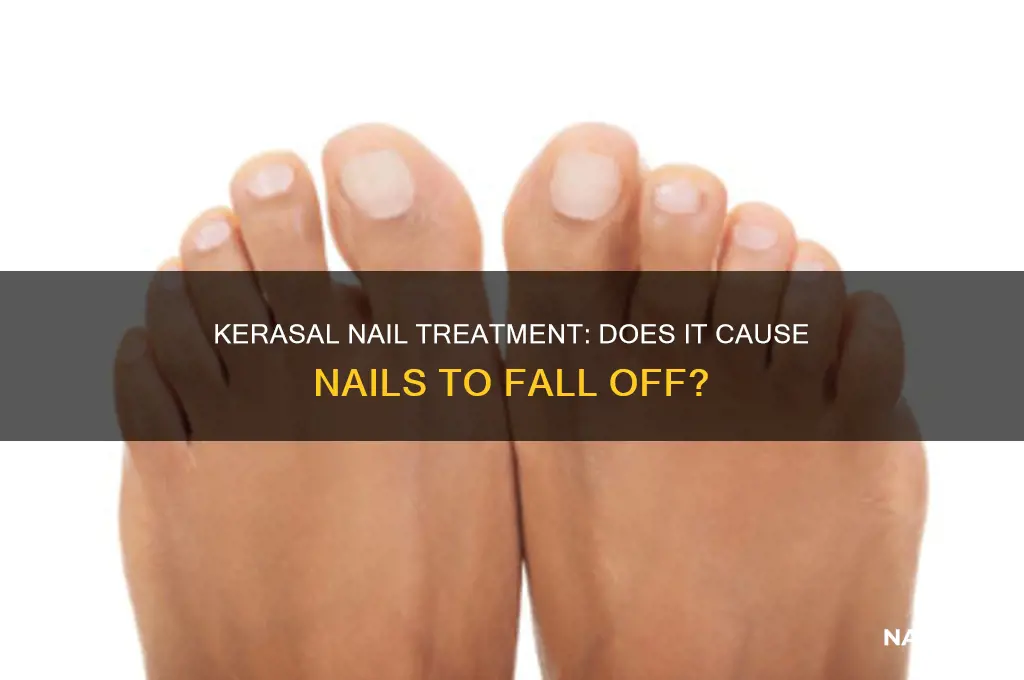 does kerasal make your nail fall off