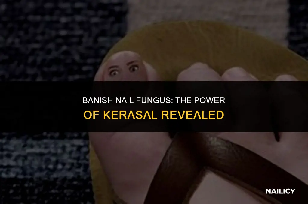 does kerasal nail get rid of fungus
