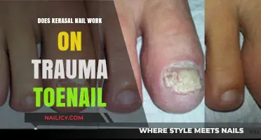 Kerasal Nail Treatment for Trauma Toenails: Does It Really Work?