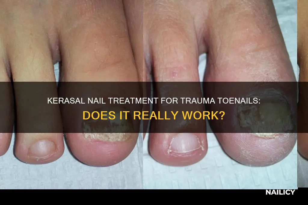 does kerasal nail work on trauma toenail
