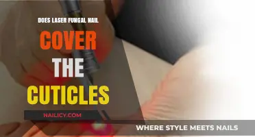 Laser Fungal Nail Treatment: Does It Cover Cuticles Effectively?