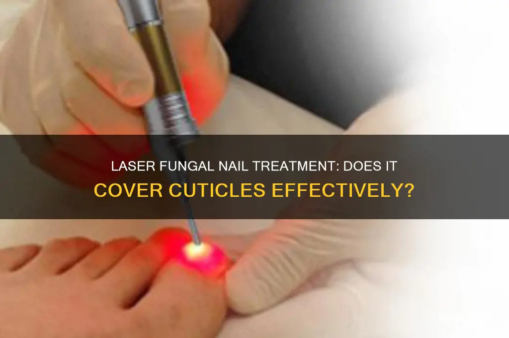 does laser fungal nail cover the cuticles