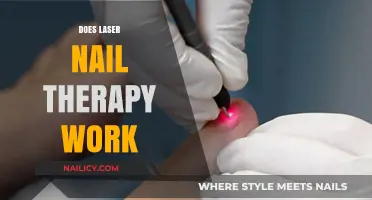 Does Laser Nail Therapy Work? Uncovering the Truth and Results