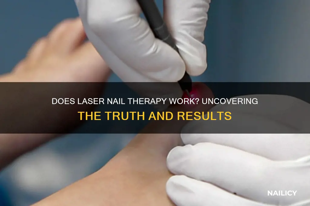 does laser nail therapy work