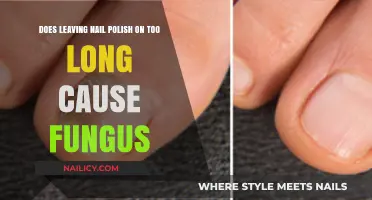 Long-Term Nail Polish Wear: Fungal Risks and Prevention Tips