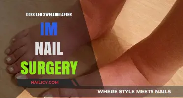 Understanding Leg Swelling Post-IM Nail Surgery: Causes and Remedies
