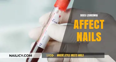 Leukemia and Nail Changes: Understanding Symptoms and Health Indicators