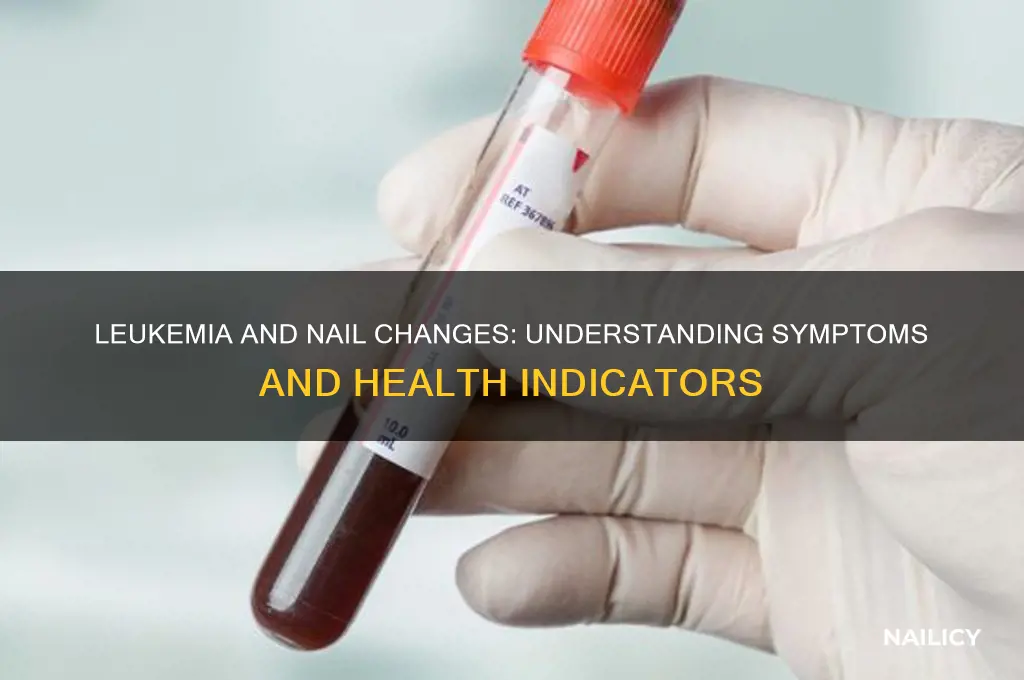 does leukemia affect nails