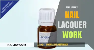 Loceryl Nail Lacquer Review: Does It Effectively Treat Fungal Infections?