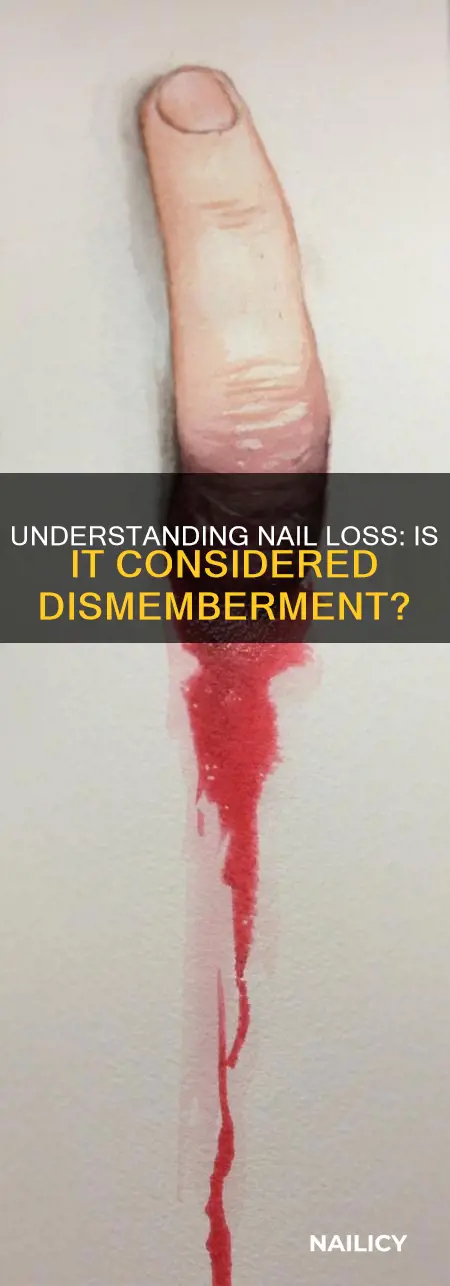 does losing a nail finger considered dismemberment