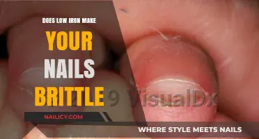 Iron Deficiency: The Link to Brittle Nails