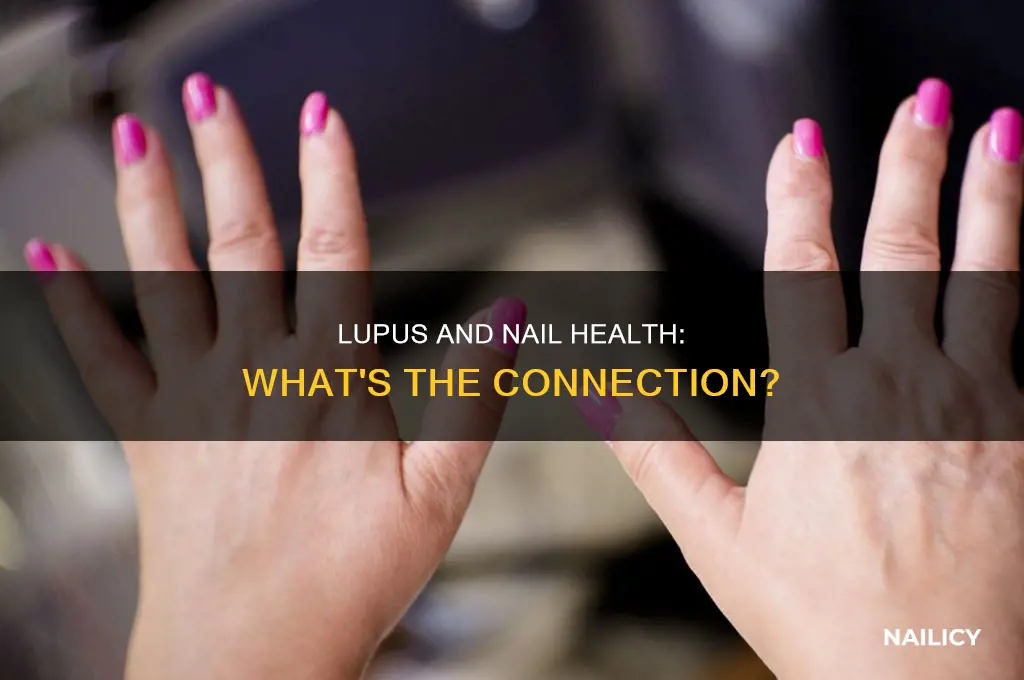 does lupus make your nails brittle