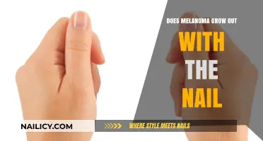 Melanoma and Nails: What You Need to Know