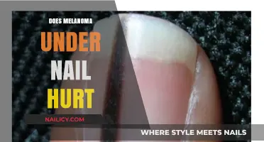 Does Melanoma Under Nail Hurt? Symptoms, Pain, and Early Detection Tips