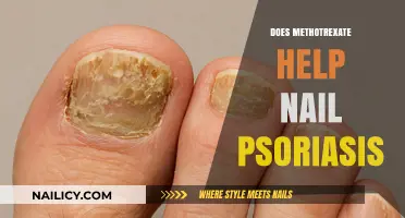 Methotrexate for Nail Psoriasis: Effectiveness and Treatment Insights