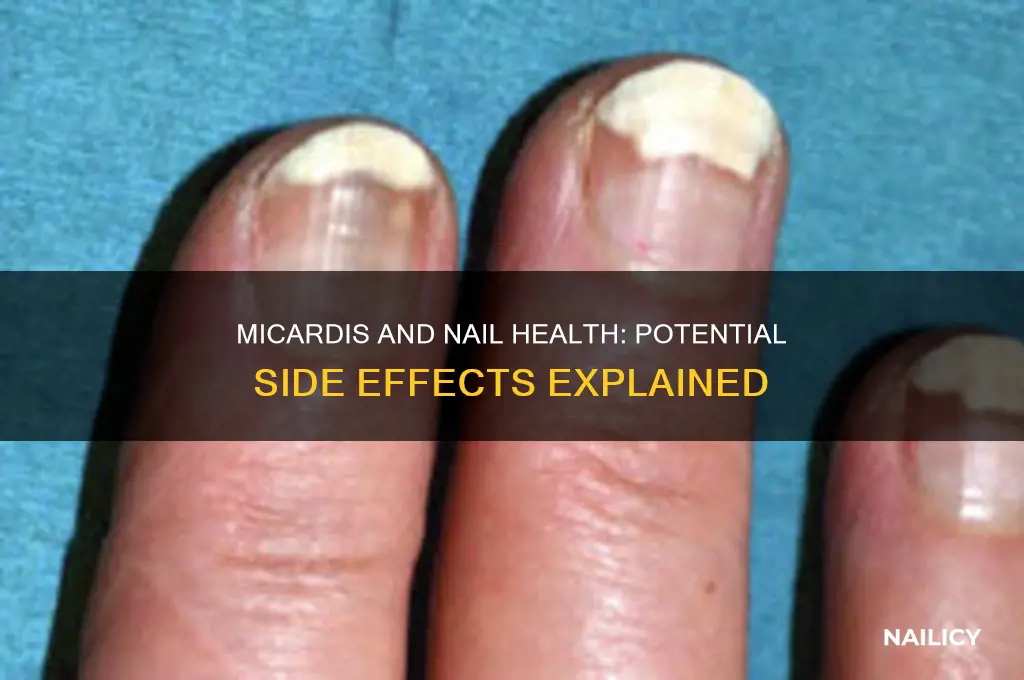 does micardis affect nails