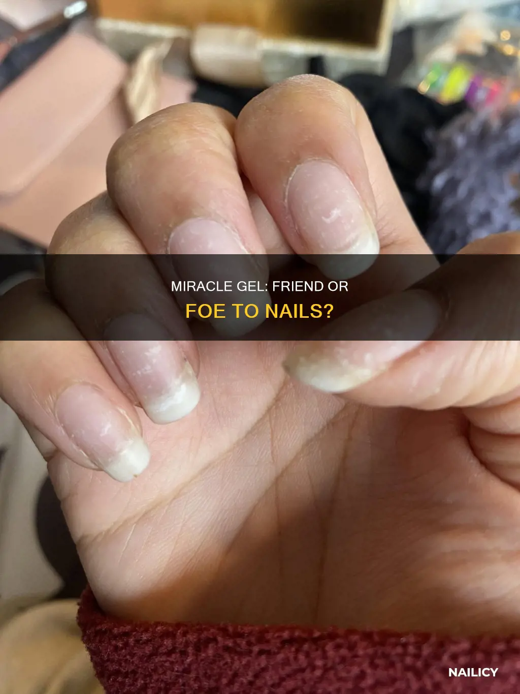 does miracle gel ruin your nails