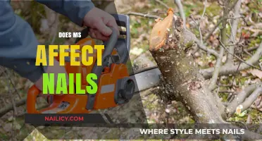 Multiple Sclerosis and Nail Health: Uncovering the Surprising Connection