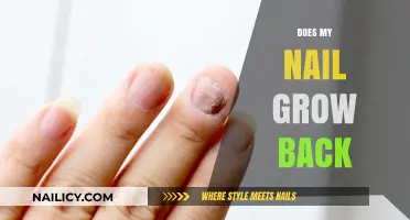 Nail Growth: What to Expect After Nail Damage