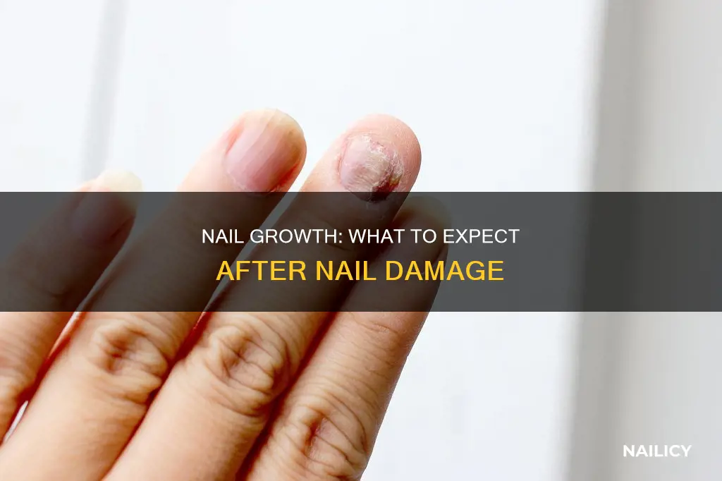 does my nail grow back