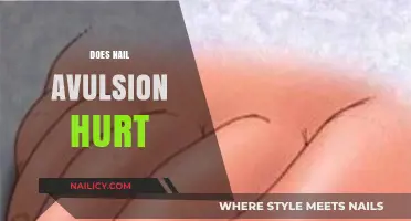 Does Nail Avulsion Hurt? Pain Expectations and Recovery Tips