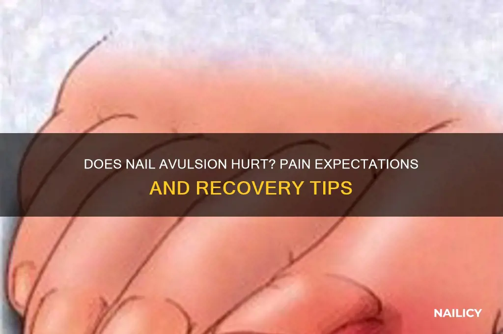does nail avulsion hurt