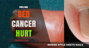Does Nail Bed Cancer Hurt? Understanding Symptoms and Early Detection
