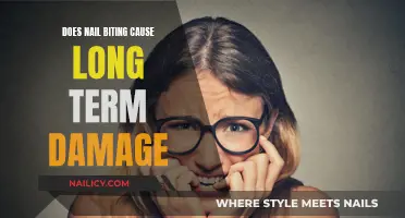 Nail Biting: What Are the Long-Term Health Risks?