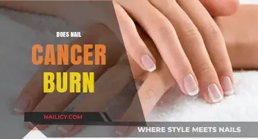 Does Nail Cancer Burn? Understanding Symptoms, Risks, and Treatment Options
