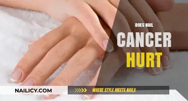 Does Nail Cancer Hurt? Understanding Symptoms and Early Detection