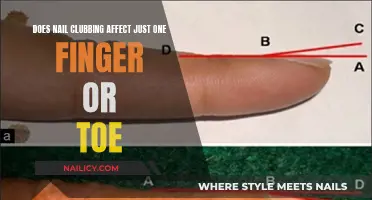 Nail Clubbing: Understanding the Impact on Multiple Digits