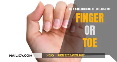 Nail Clubbing: One Finger, One Toe, What's the Deal?