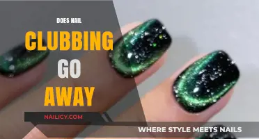 Can Nail Clubbing Be Reversed? Understanding Causes and Treatment Options